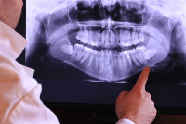 Best Urgent Care for Lost Fillings or Crowns in Dillon, MT